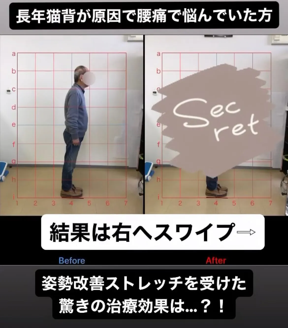 【腰痛改善するなら久留米市サザン整骨院☝️】