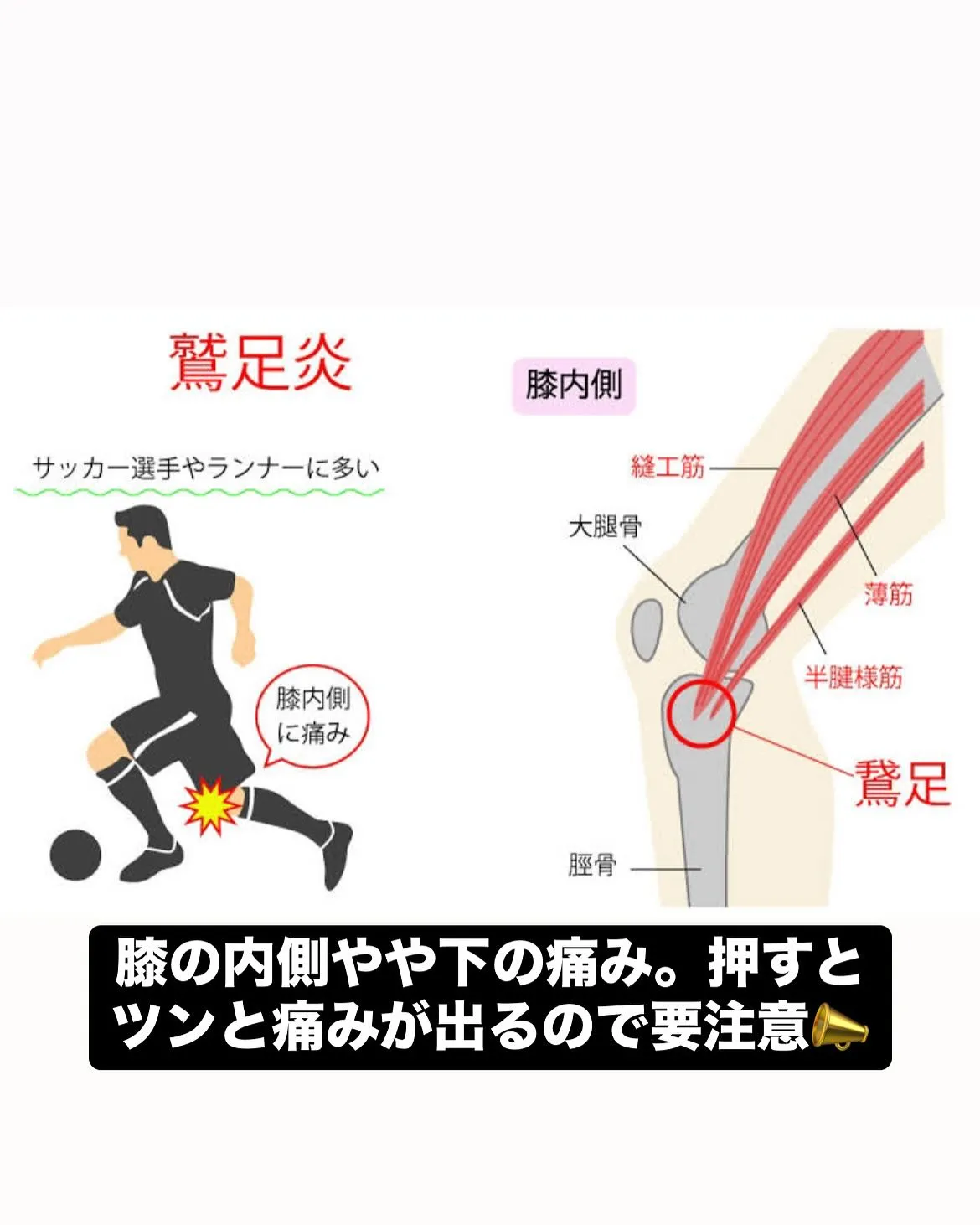 【成長痛治療なら久留米市サザン整骨院☝️】