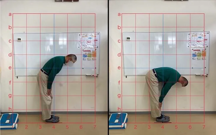 【ギックリ腰治療するなら久留米市サザン整骨院☝️】