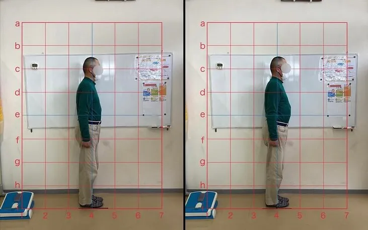 【ギックリ腰治療するなら久留米市サザン整骨院☝️】