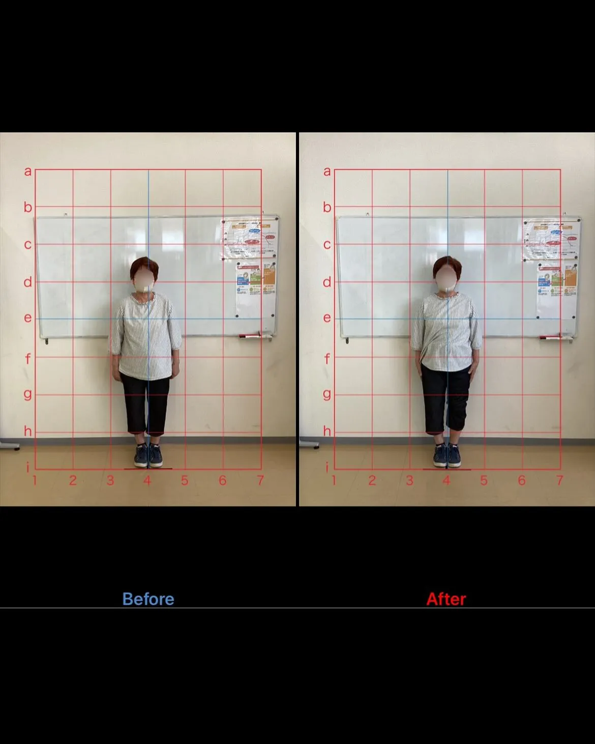 【腰痛神経痛改善するなら久留米市サザン整骨院☝️】