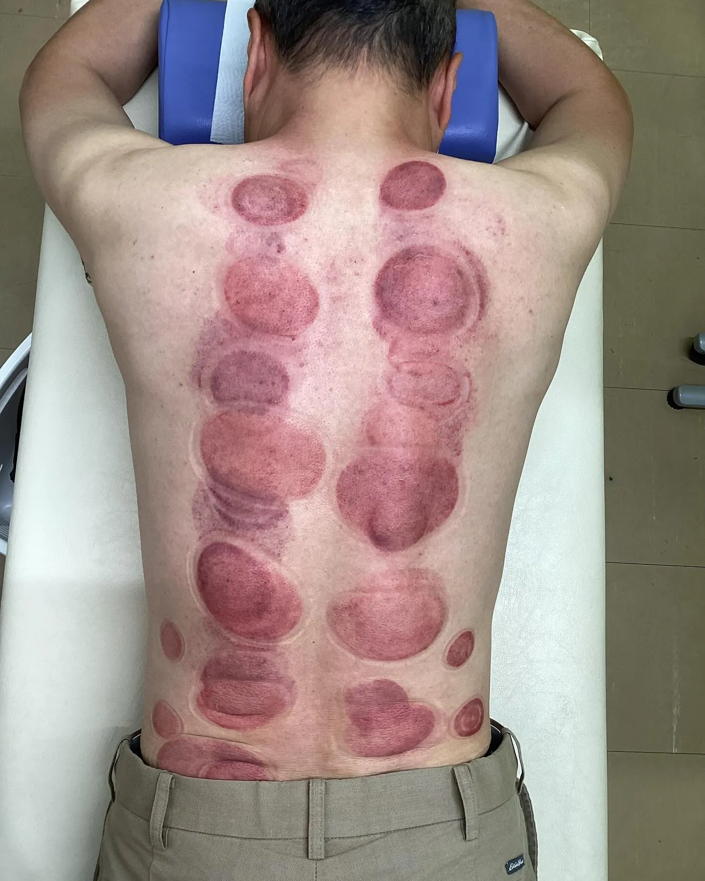 【肩こり腰痛治療なら久留米市サザン整骨院☝️】