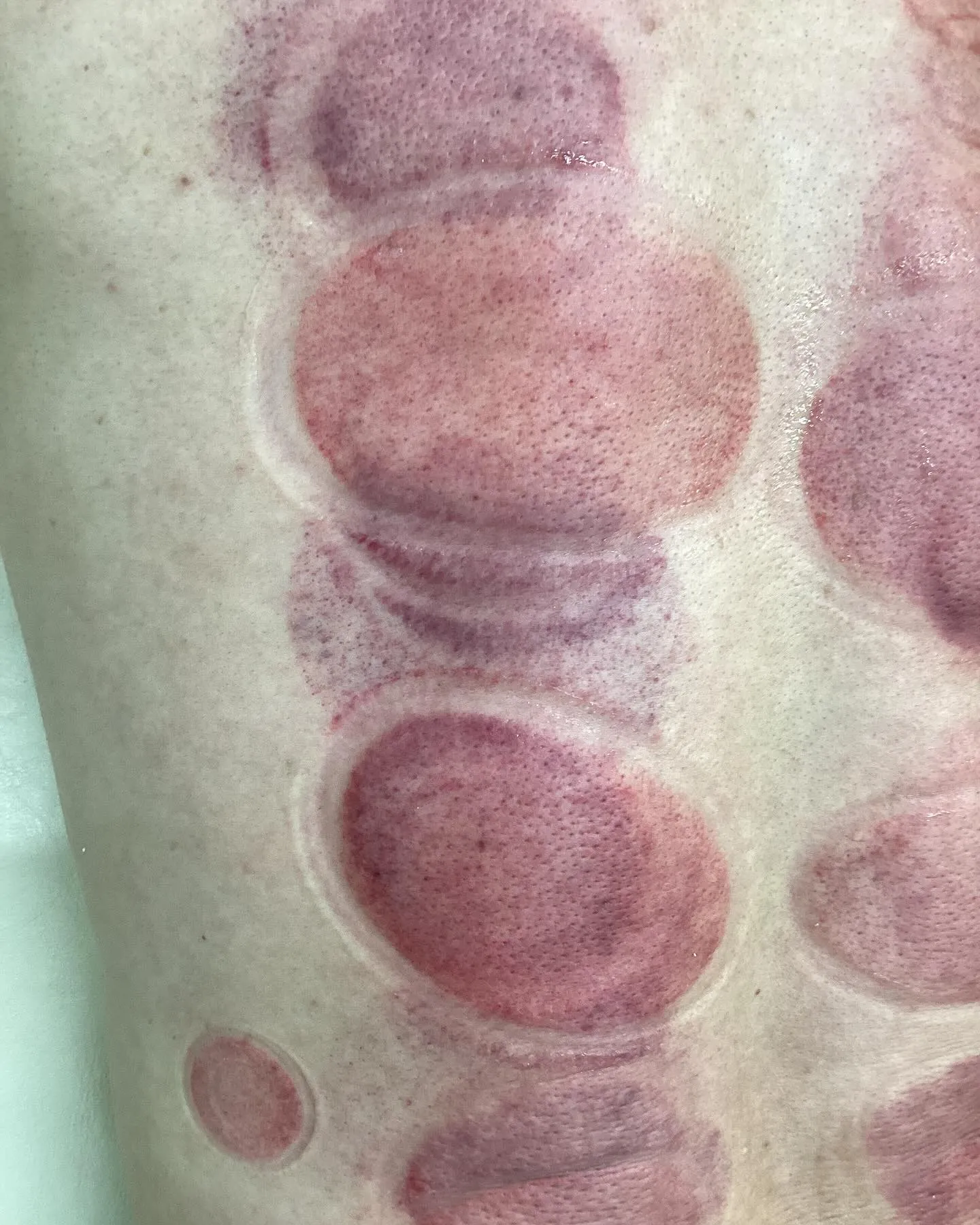 【肩こり腰痛治療なら久留米市サザン整骨院☝️】