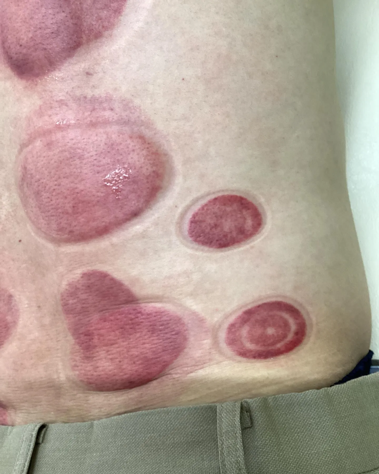 【肩こり腰痛治療なら久留米市サザン整骨院☝️】