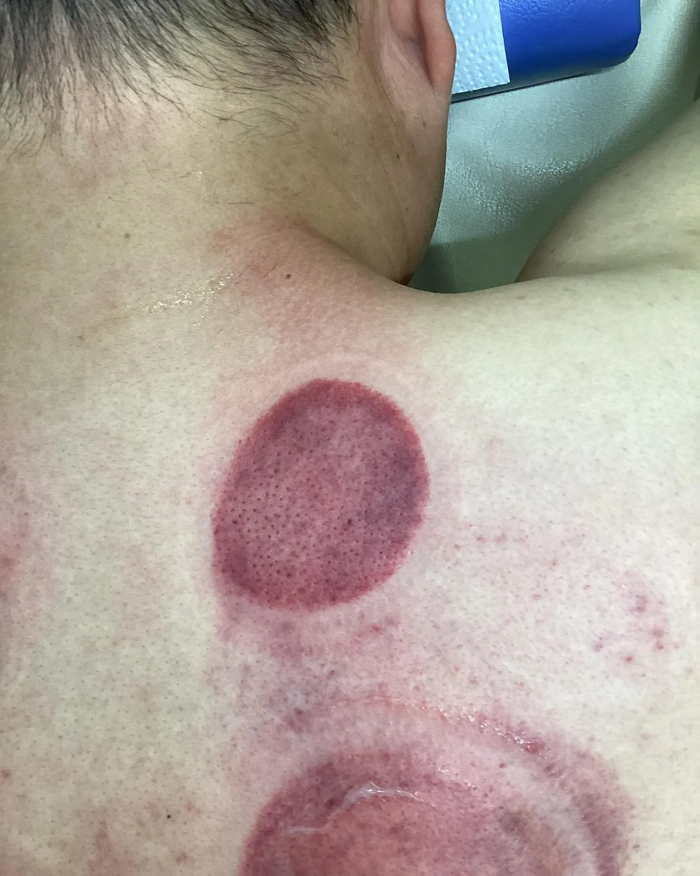 【肩こり腰痛治療なら久留米市サザン整骨院☝️】