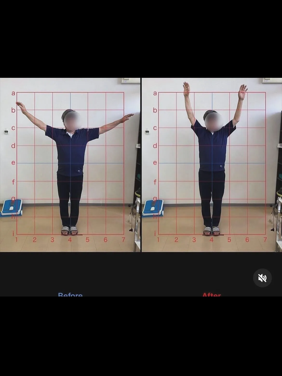 【肩こり・四十肩五十肩治療するなら久留米市サザン整骨院】