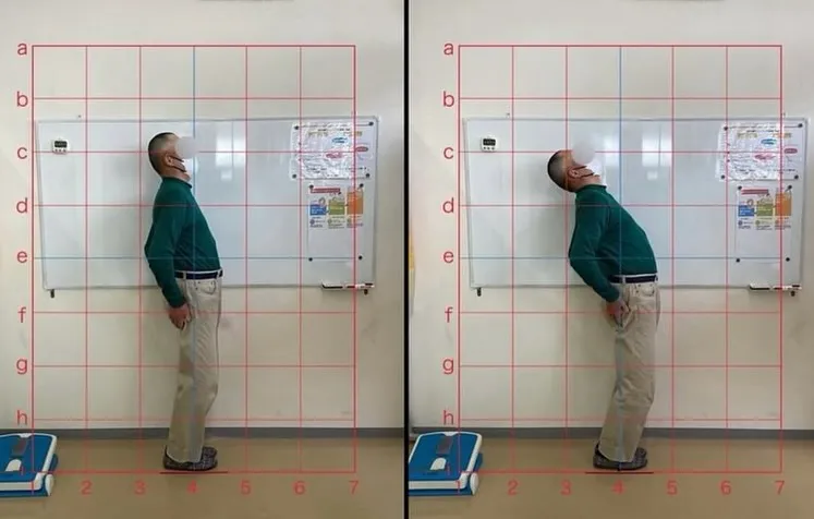 【ギックリ腰治療するなら久留米市サザン整骨院☝️】