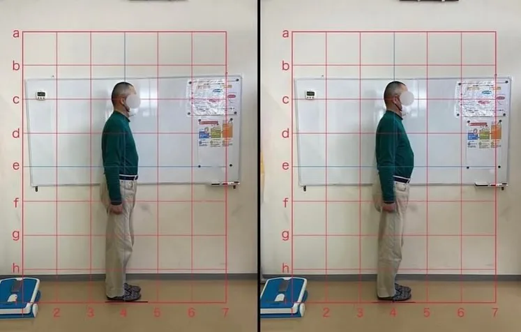 【ギックリ腰治療するなら久留米市サザン整骨院☝️】