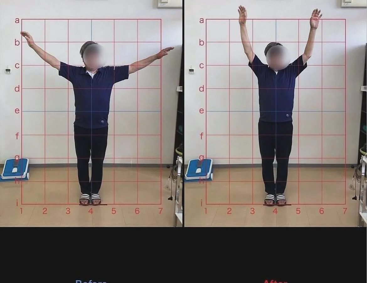 【四十肩五十肩治療するなら久留米市サザン整骨院☝️】