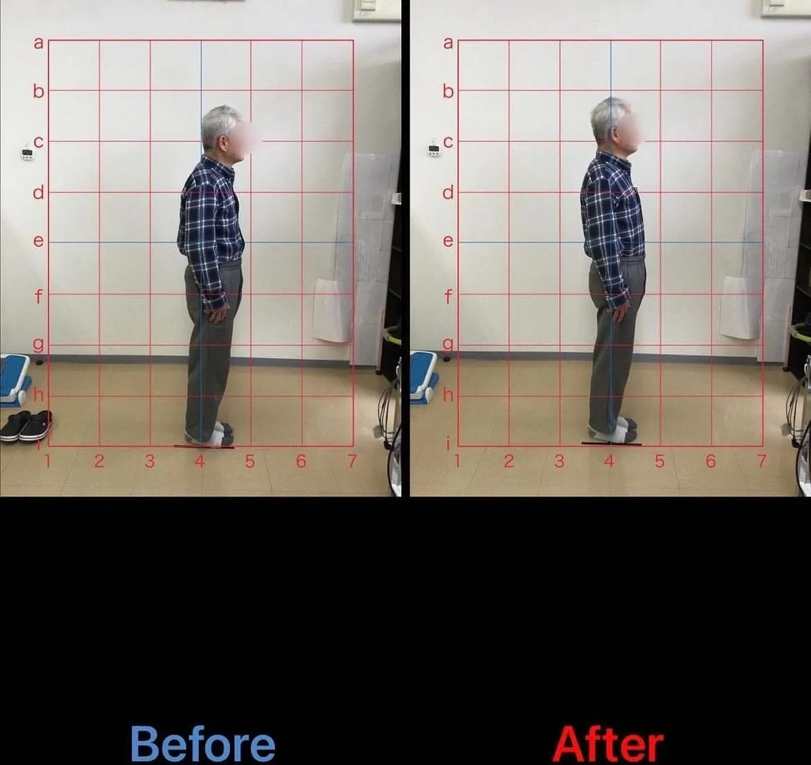 【猫背矯正するなら久留米サザン整骨院☝️】