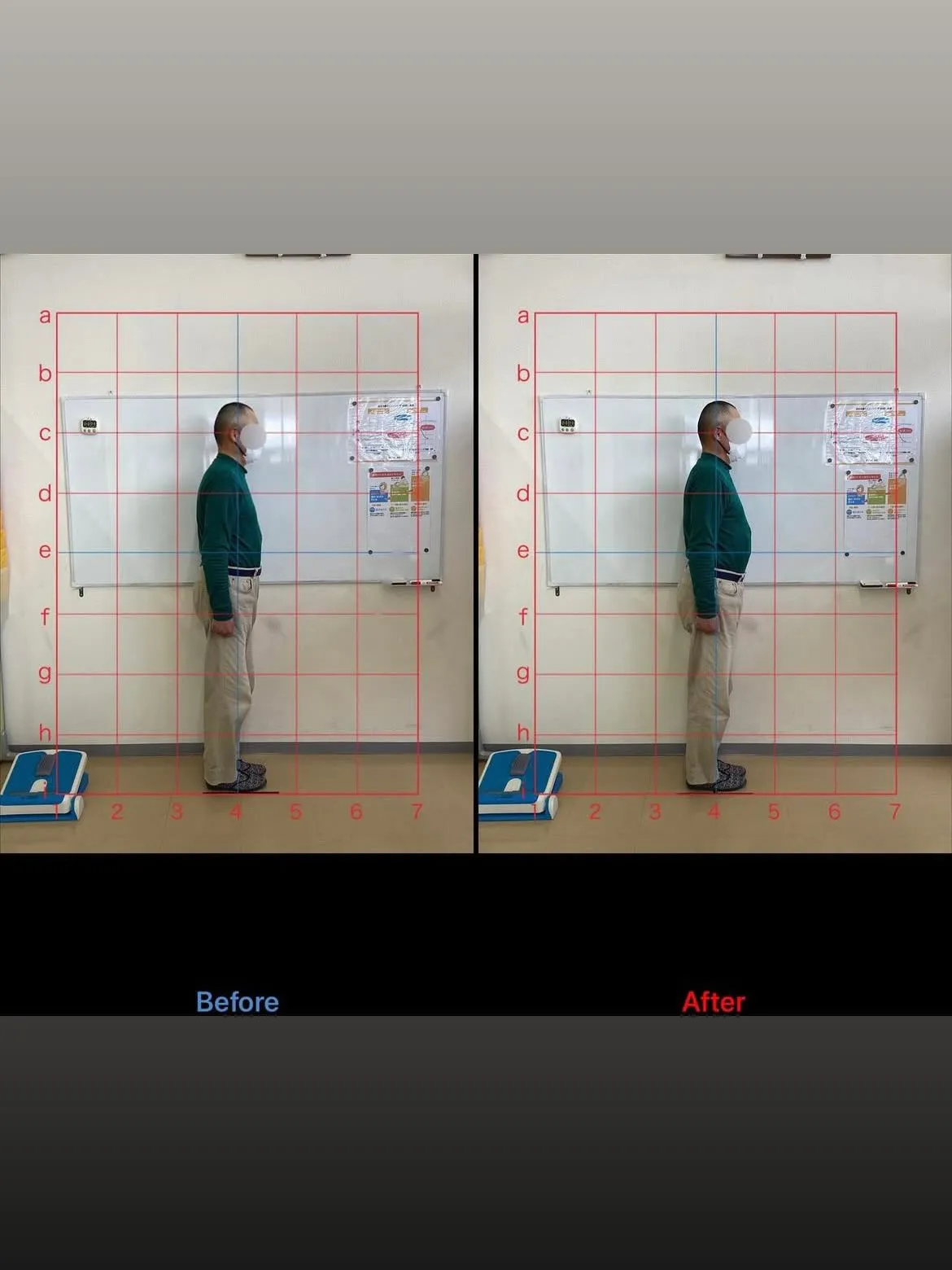 【猫背矯正するなら久留米市サザン整骨院】