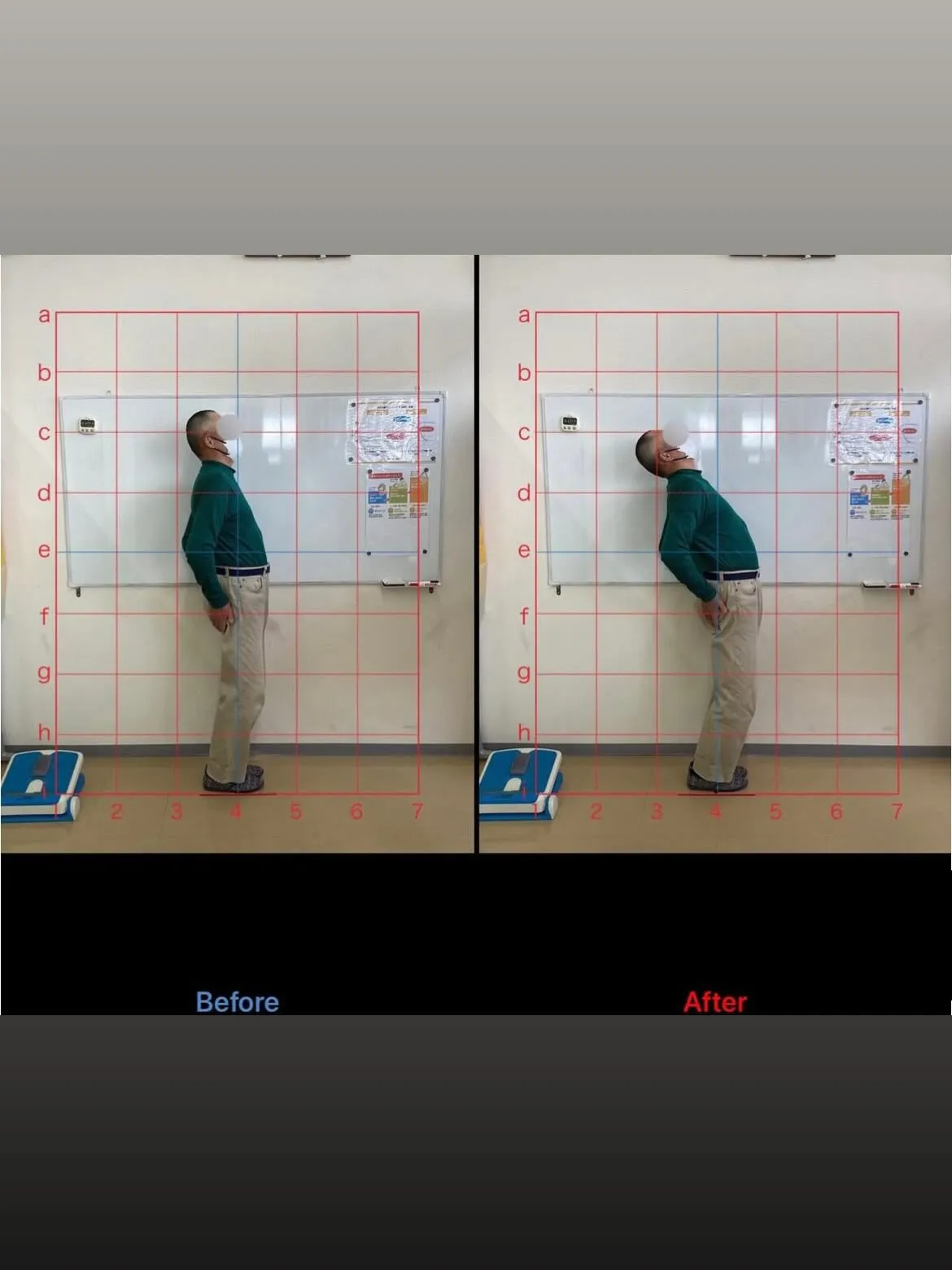 【猫背矯正するなら久留米市サザン整骨院】