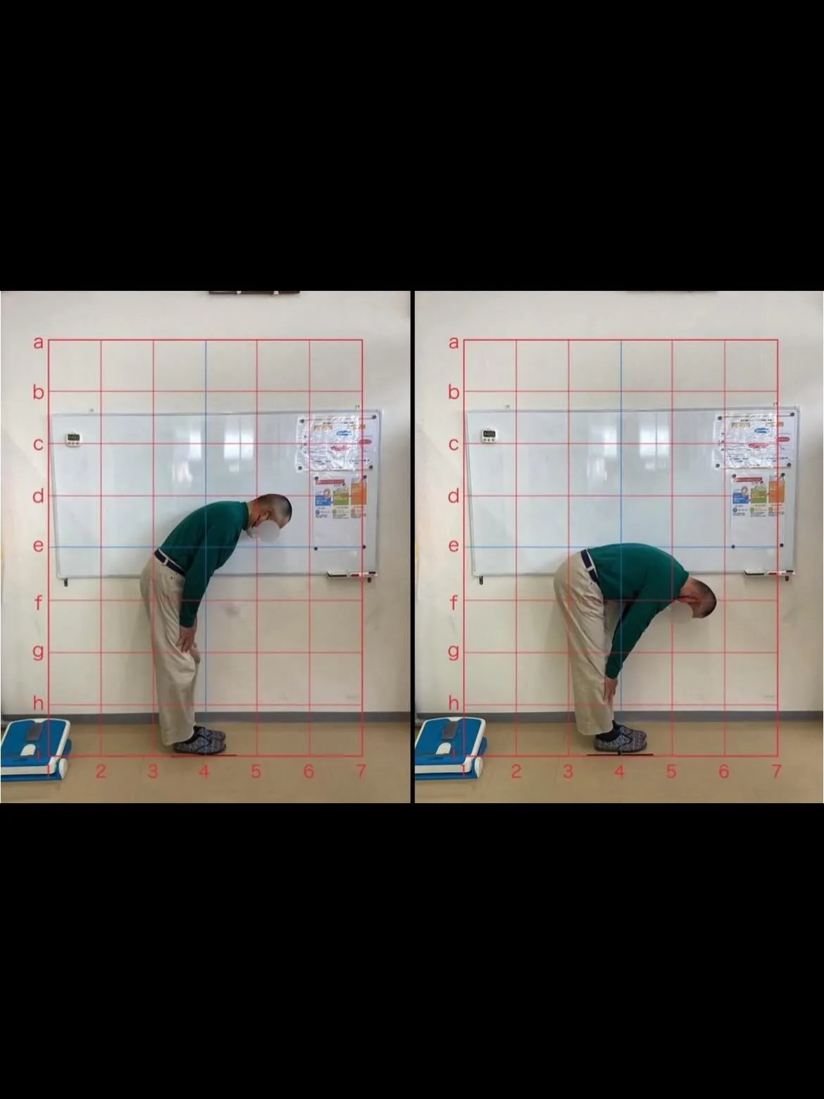 【猫背矯正するなら久留米市サザン整骨院】