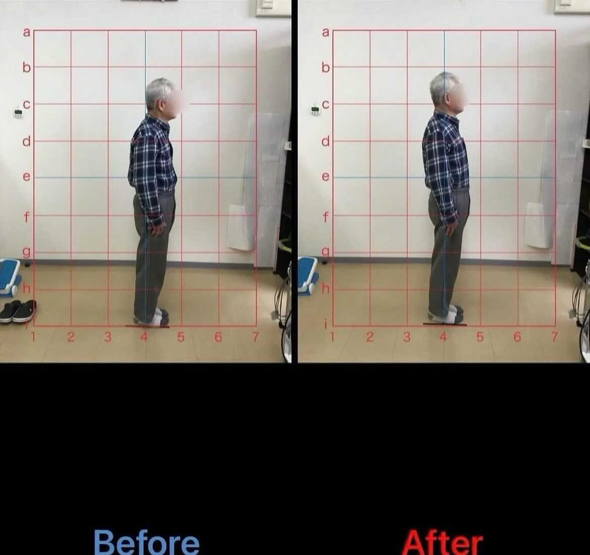 【猫背治療は久留米サザン整骨院☝️】