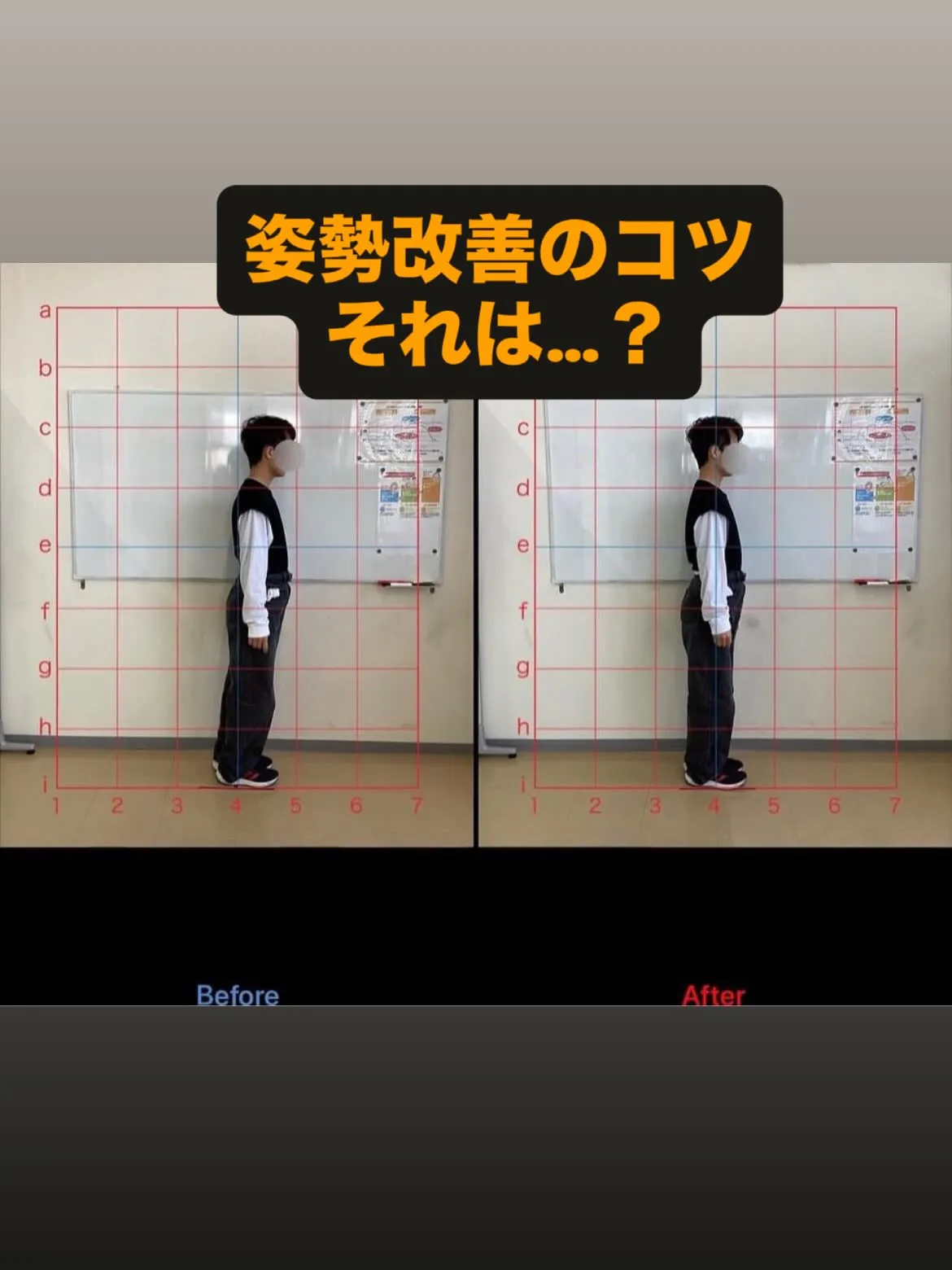 【猫背治療は久留米サザン整骨院☝️】