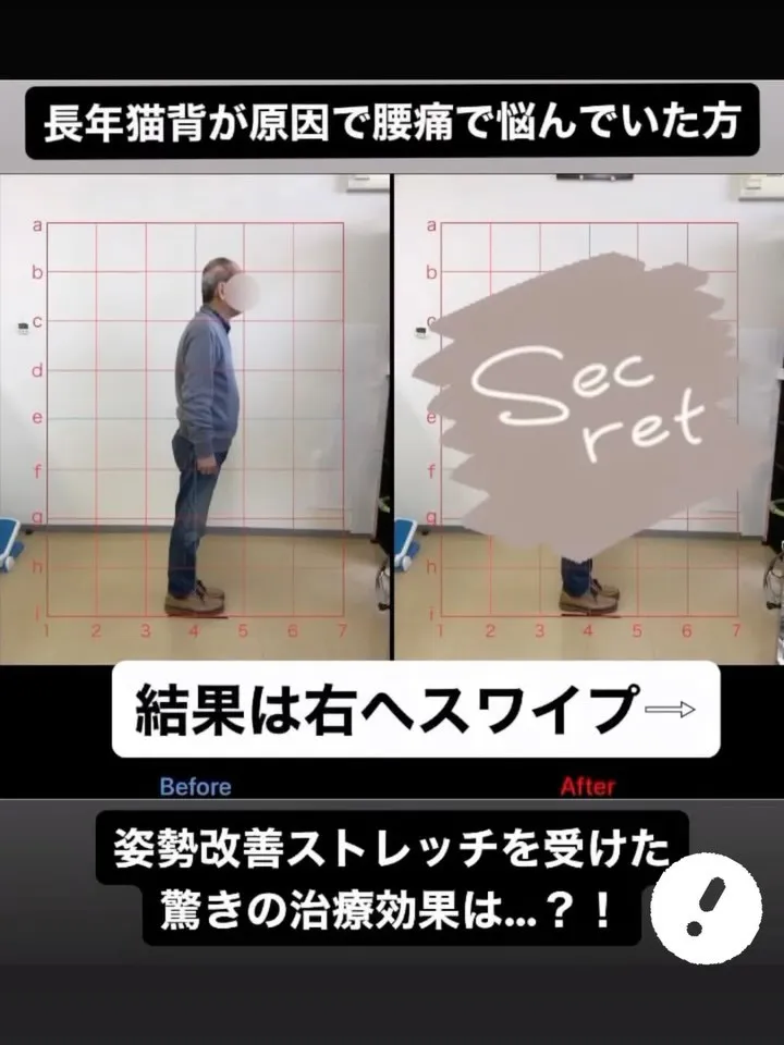 【腰痛改善するなら久留米市サザン整骨院☝️】