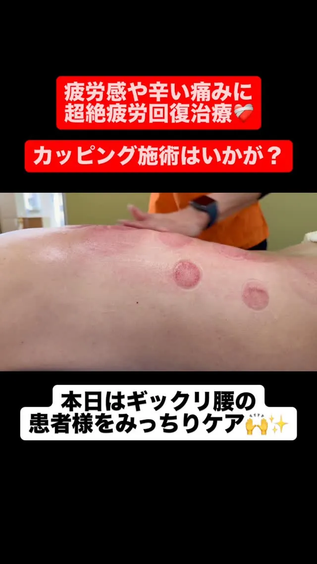 【ギックリ腰治療は久留米市サザン整骨院☝️】