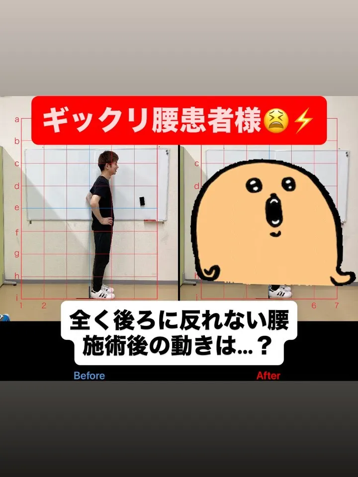 【腰痛は久留米市サザン整骨院で☝️】