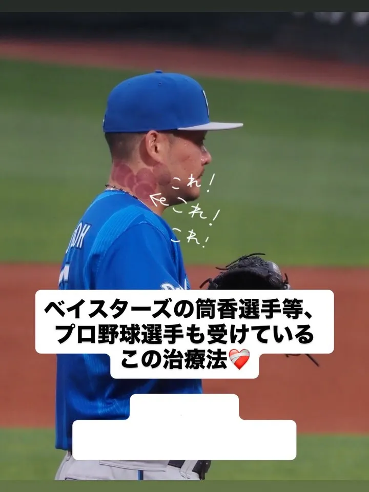 【カッピング治療は久留米サザン整骨院☝️】