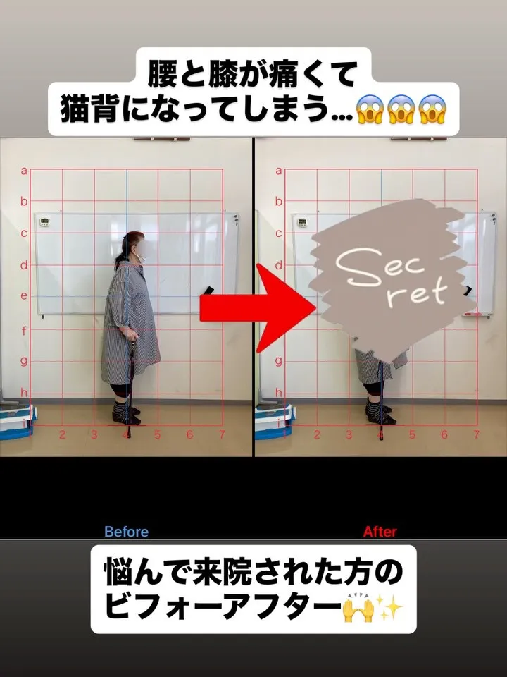【腰痛治療は久留米サザン整骨院☝️】
